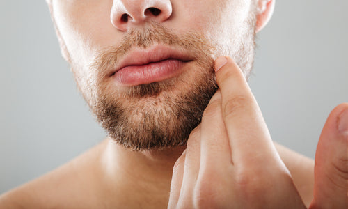 How to Grow Facial Hair: Are There Solutions That Work?