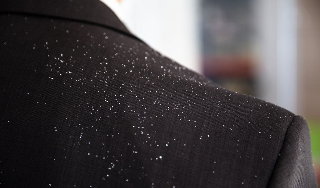 dandruff on shoulder of black coat