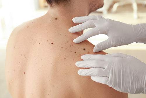 dermatologist examining patient's back