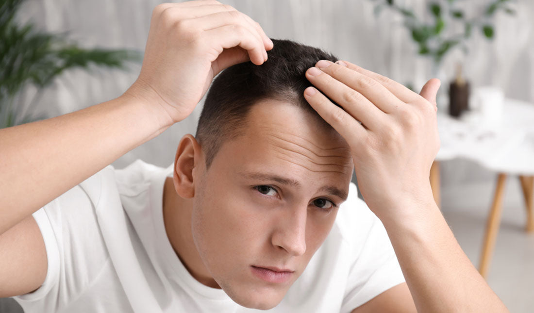 man checking hair line